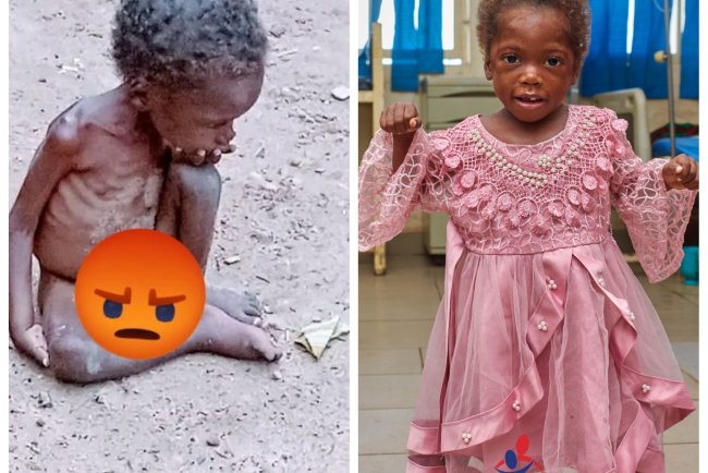 Remarkable Recovery for Malnourished Child Found Abandoned in Benue