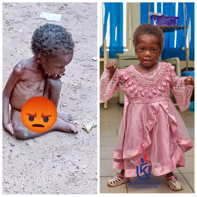 Remarkable Recovery for Malnourished Child Found Abandoned in Benue