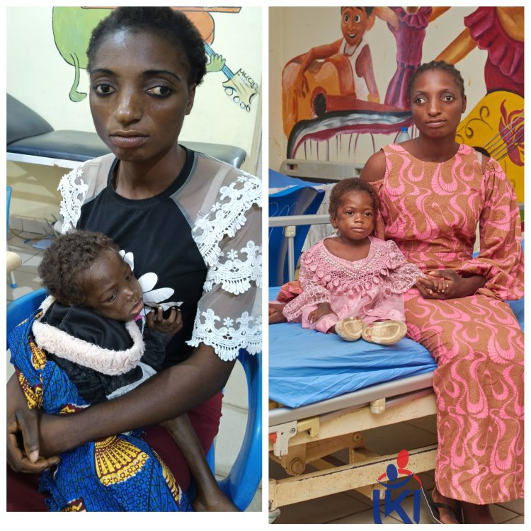Remarkable Recovery for Malnourished Child Found Abandoned in Benue