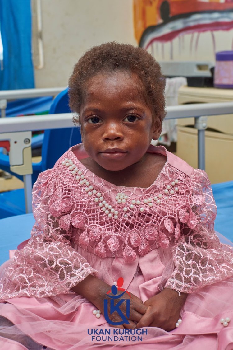 Remarkable Recovery for Malnourished Child Found Abandoned in Benue