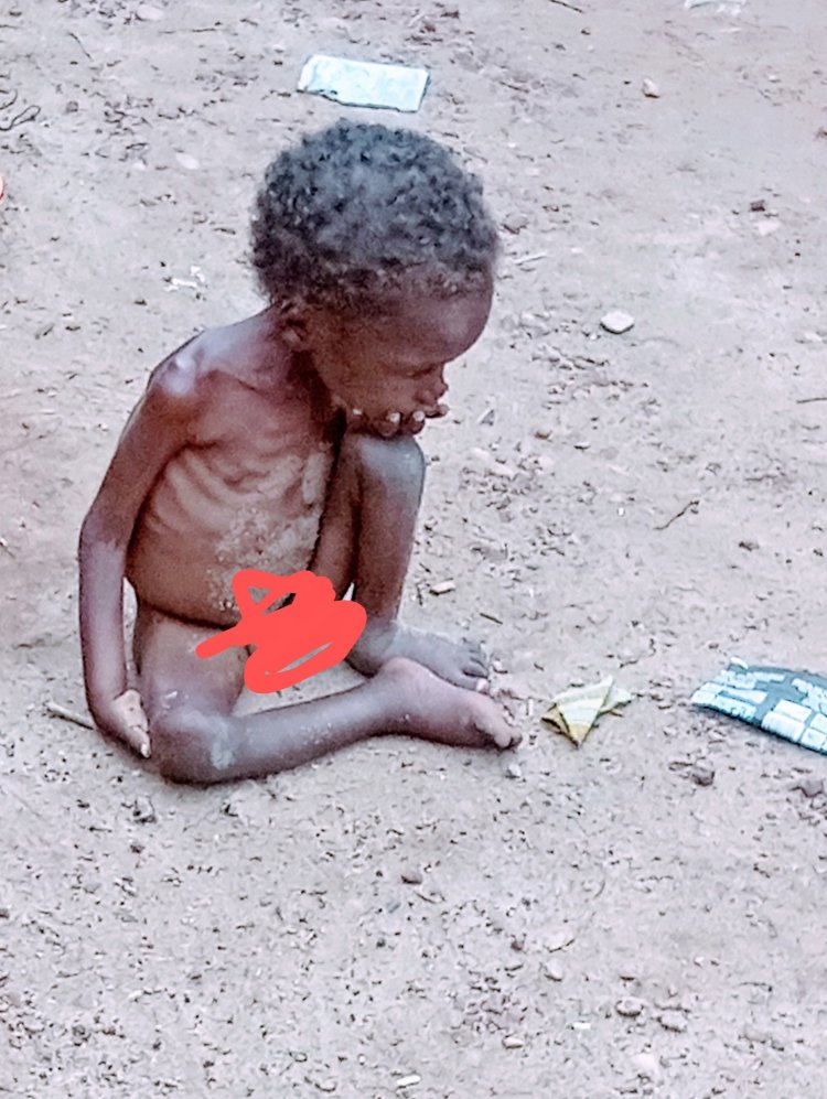Remarkable Recovery for Malnourished Child Found Abandoned in Benue